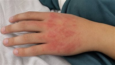 غموض علامات يوسف 